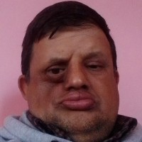 D A
