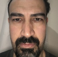 Serkan ILGAR