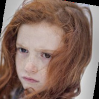 vitiligo cure