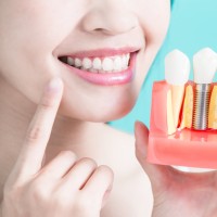Dental Consultation