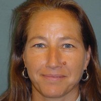 Lynn Dombek