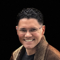 Alain Polynice, MD, FACS