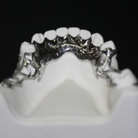 China Dental Laboratory