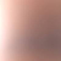 M K