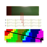 Medical Delta Cardiac Arrhythmia Lab