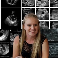 Natalie Venter