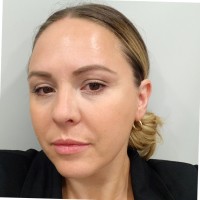 francesca fustinoni