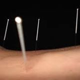 Edward Simons Acupuncture
