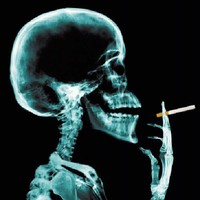 Carlos Almeida casom.uk