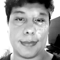 Herbert Galdamez