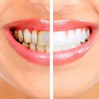 West Dental Dental Clinic