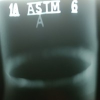 mauricio diego Agniolin