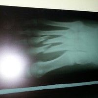 Osvaldo Annicchiarico