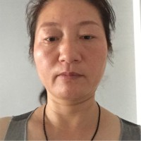 朱晓琴