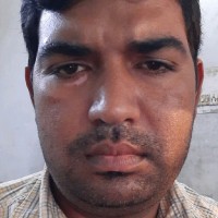 KAPTAN SINGH