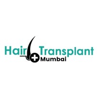 Hair Transplant Mumbai