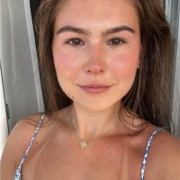 Chloe Foster