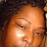 Veneer Sanogo