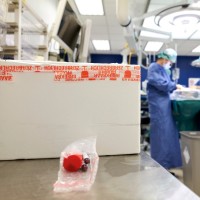 Transplantatie Uz Gent