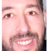 Adlene Bouakkaz