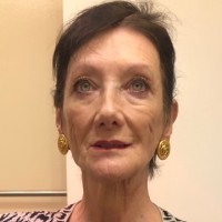 Alice Patterson