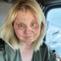 Judi Hall