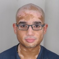 Aakashdeep Gupta
