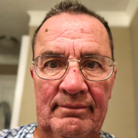 Philip Bergstresser