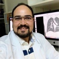 Matheus Grilo