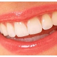 Dental Web