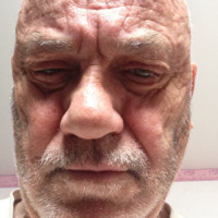 Serge BREDILLET