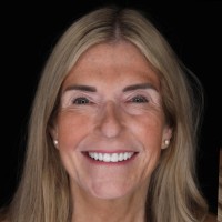 Carrie Becker