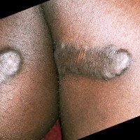 Lukkies Mbaziira