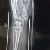 王全金
