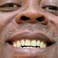 Peter Adongo