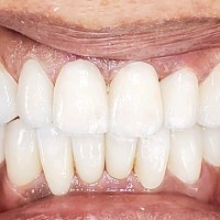 Lucas Figueiredo da Silva