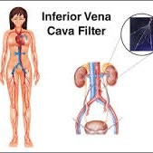 Tort Marketing Group