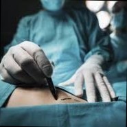 Jasthetrecostr Surgery