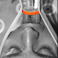 Kevin Hynes-Evangelista