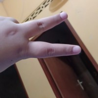 Limit Lumit