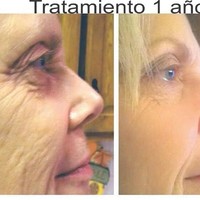 Eunice Cotera; regresa a tu talla y a tu juventud