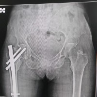 X-RAYat Home services all Ahmedabad R B NAYAK