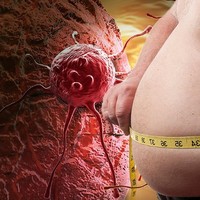 Baoj Obesity And Weight Loss Management