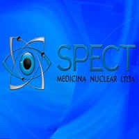 Spect Medicina Nuclear