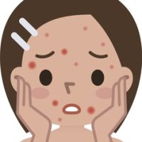 Pimple Video