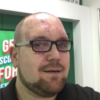 Dave Suckling