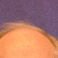 Chris Robey