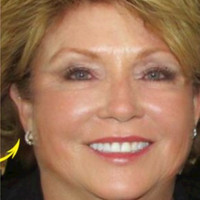 Shirley Rigo