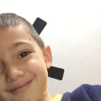 Carson Scheerer