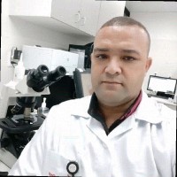 Otaniel De Almeida Lima
